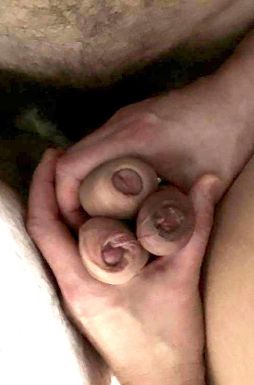 Best pic from r/foreskin