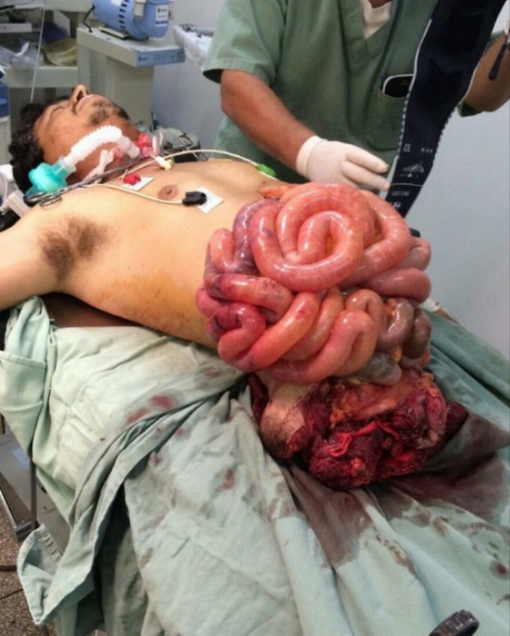 Best pic from r/MedicalGore