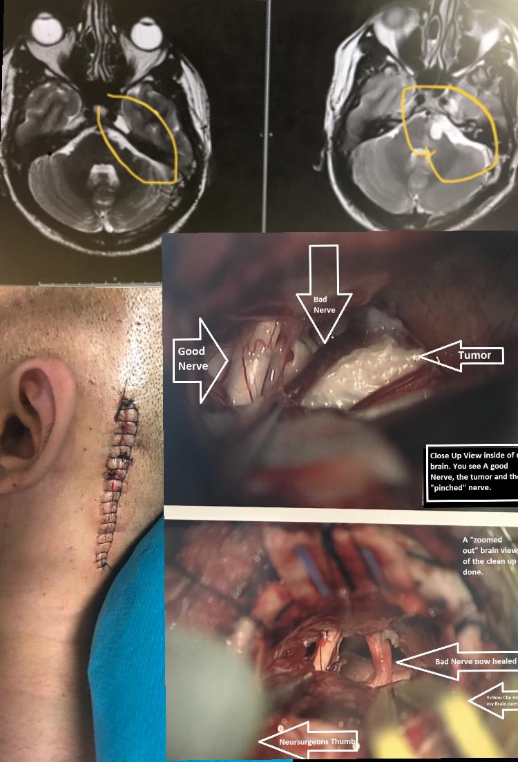 Best pic from r/MedicalGore