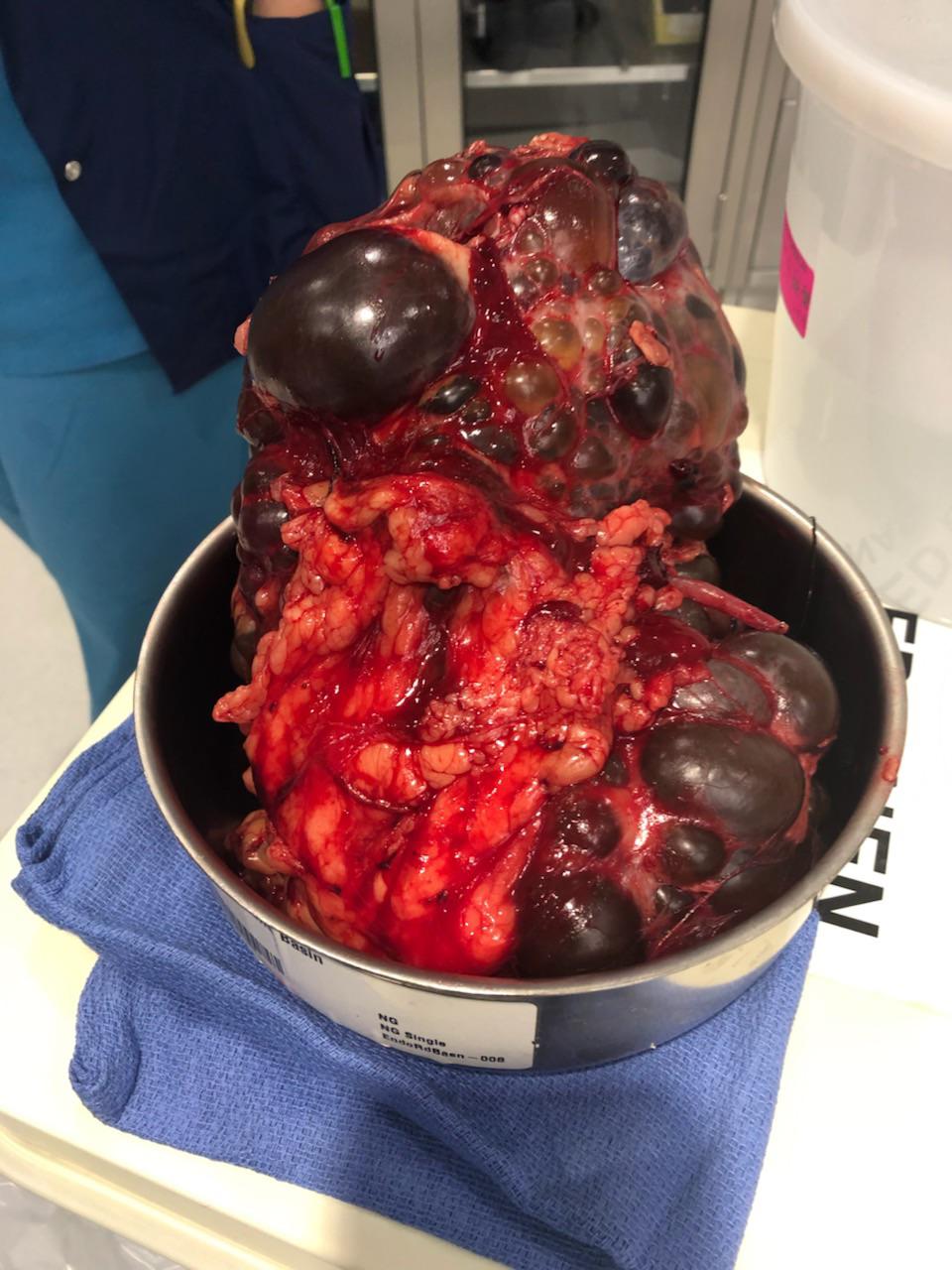 Best pic from r/MedicalGore