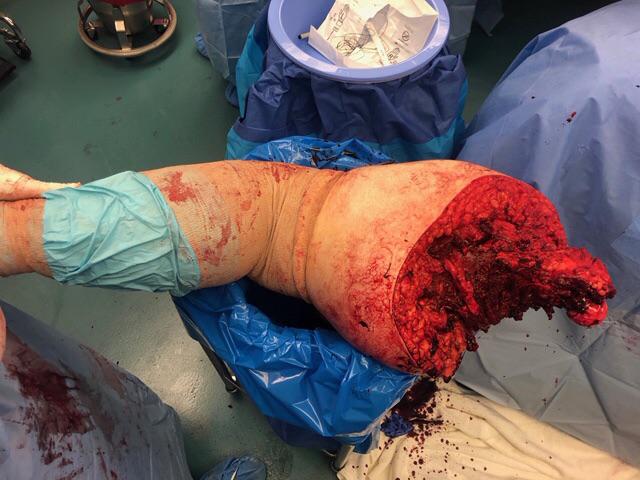 Best pic from r/MedicalGore