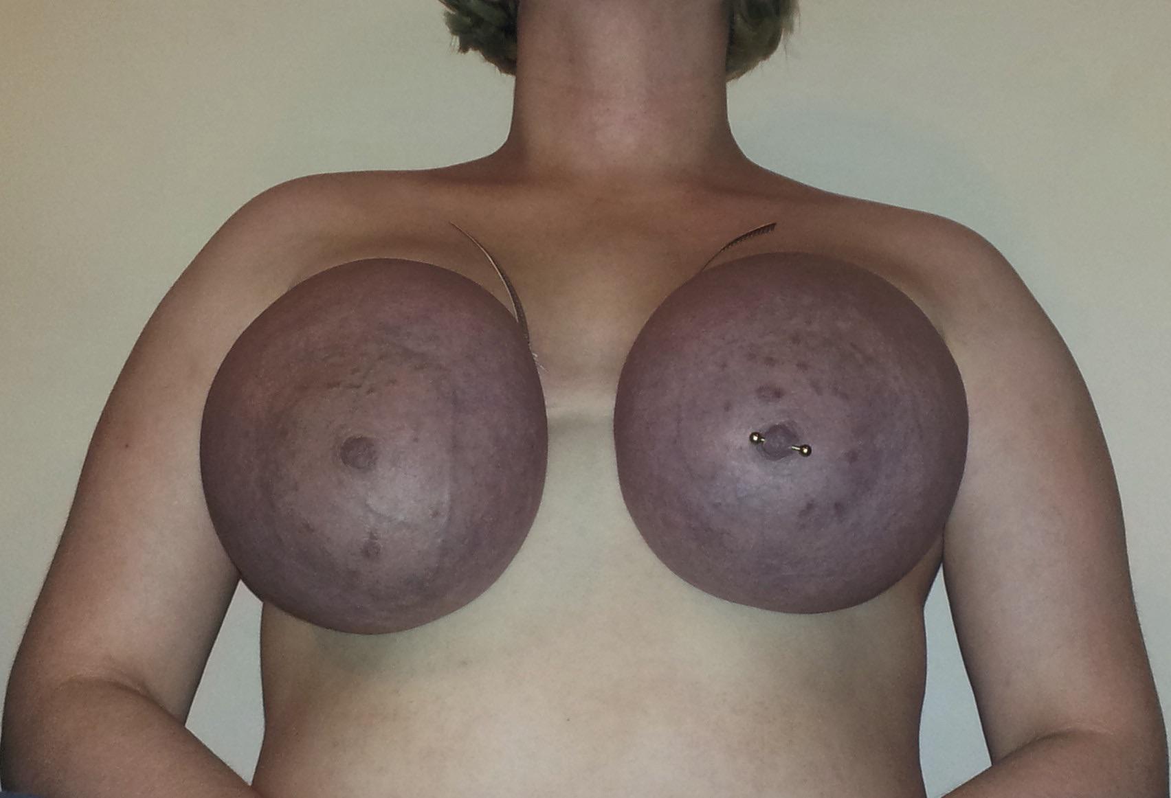 Best pic from r/PurpleTits