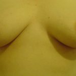 breastgallery