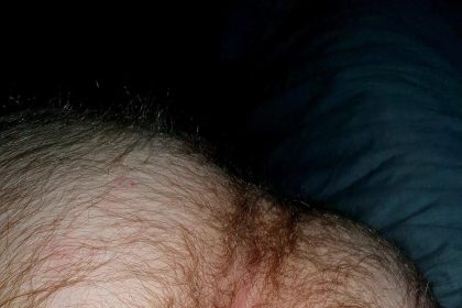 Hairymanass