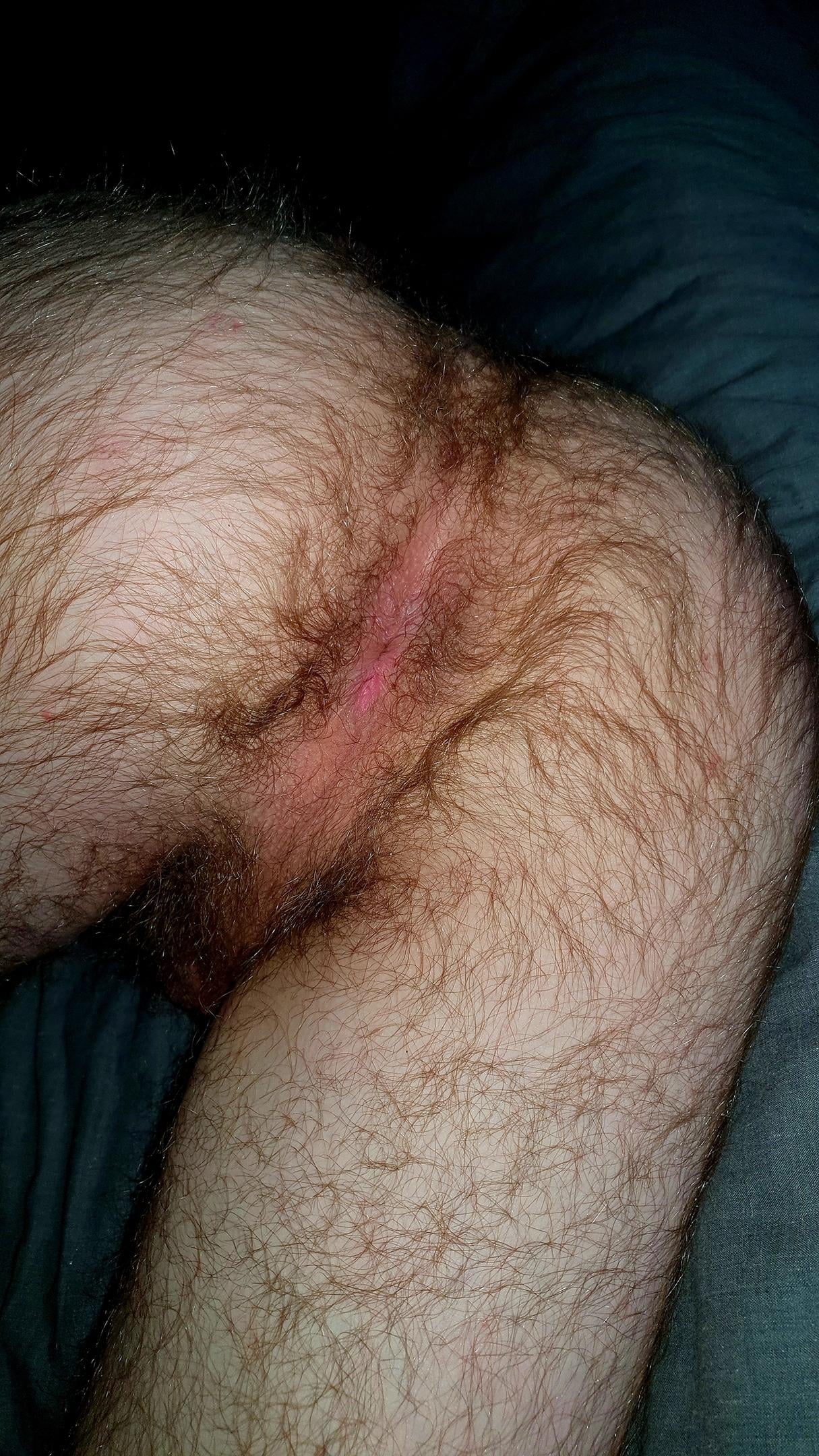 Hairymanass