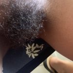 hairypie