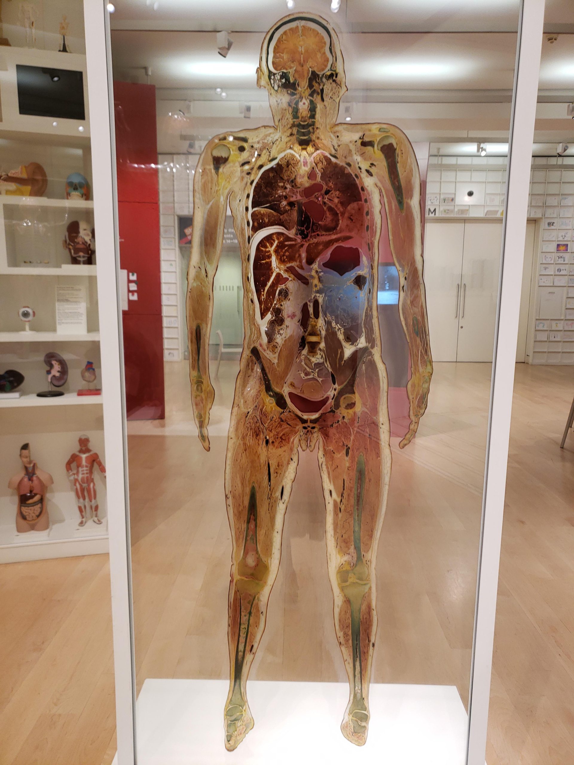 Saw this at a museum in London. A preserved slice of a female body